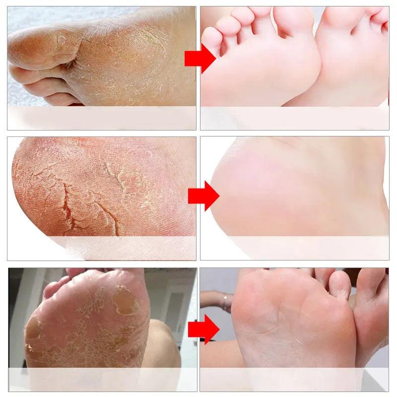 Exfoliating Foot Mask Spa Pedicure Socks Remove Dead Skin Whitening Feet Peeling Anti-Cracked Foot Skin Care - Tartaruga Shop