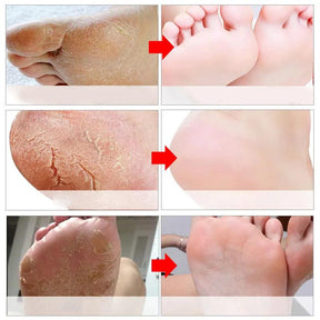 Exfoliating Foot Mask Spa Pedicure Socks Remove Dead Skin Whitening Feet Peeling Anti-Cracked Foot Skin Care - Tartaruga Shop